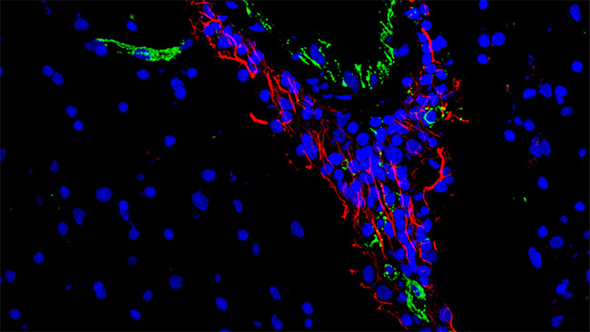 EGFL7 bindet Immunzellen im perivaskulären Raum in MS-Läsionen
