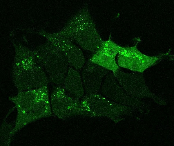 Autophagie sichtbar machen: Mittels Fluoreszenzmikroskopie können die Recyclinganlagen der Autophagie näher untersucht werden. Hier sind die sogenannten Autophagosomen, kleine Membranvesikel, die das abzubauende zelluläre Material wie z.B. verklumpte Proteine enthalten, grün angefärbt worden. (Bild: Dr. Heide Genau, Frankfurt am Main) Autophagosomen, grün angefärbt