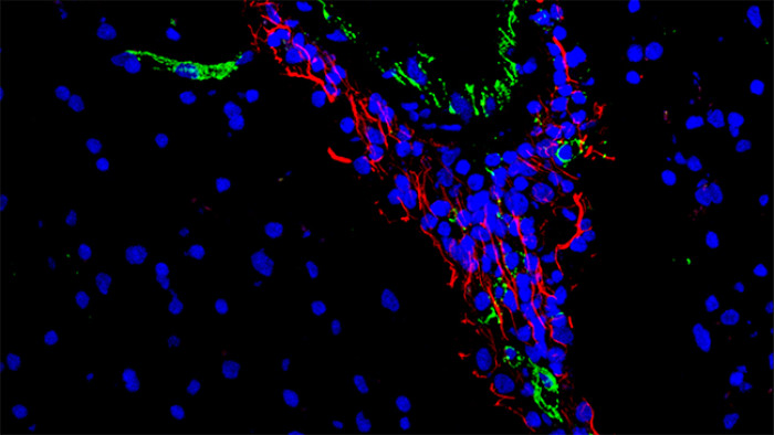EGFL7 tethers immune cells to the perivascular space in MS lesions